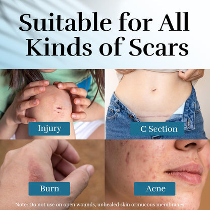 CLNABFR Advanced Scar Cream - Silicone Scar Treatment for Postoperative, Burns & Acne Scars, 1.76 oz