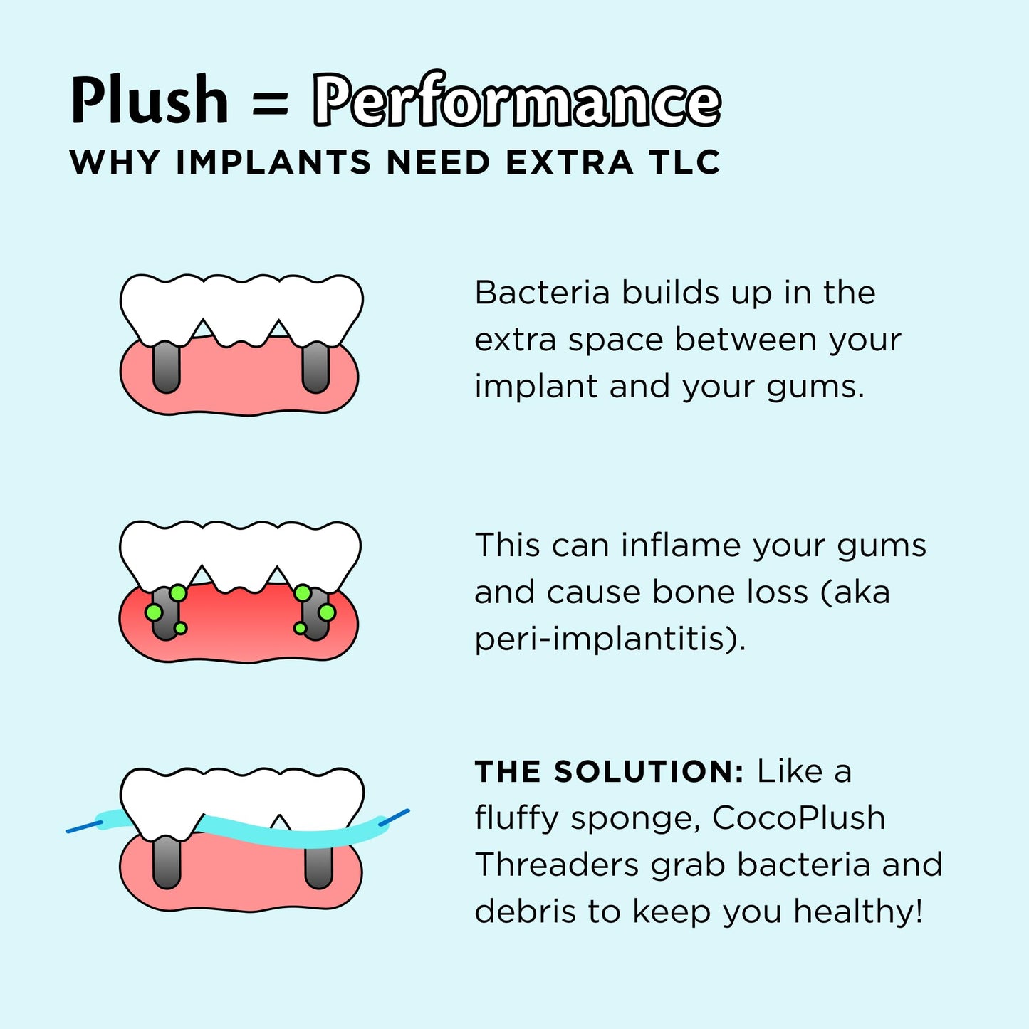 Cocofloss CocoPlush Threaders – Dental Floss for Implants, Bridges & Braces