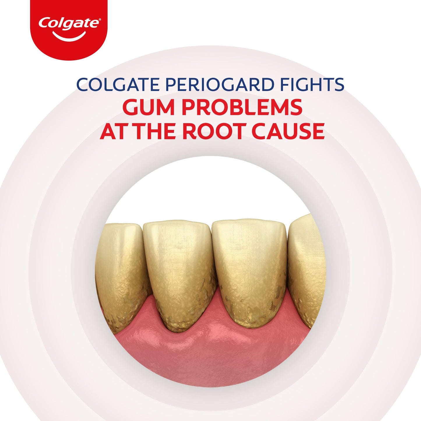 Colgate Gum Protection PerioGard Toothpaste 90grm/3.2oz – Helps Fight Plaque & Keep Gums Healthy