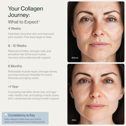 Colla Vita Grass-Fed Collagen Peptides – Type I & III, Unflavored, 10 oz