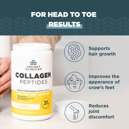 Ancient Nutrition Collagen Peptides Powder – Vanilla, 20g per Serving, 12 Servings | Skin, Joint & Gut Support | Keto & Paleo