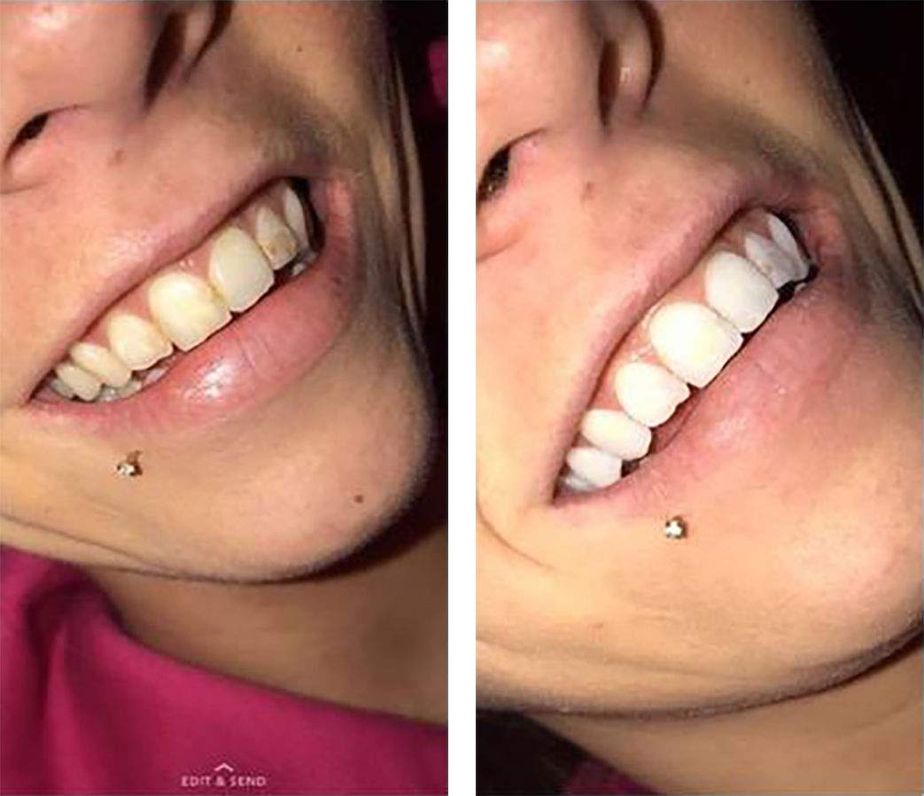 Color Wheel Teeth Whitener (Mint) - Instantly Whitens Teeth | Easy to Use | 4 oz