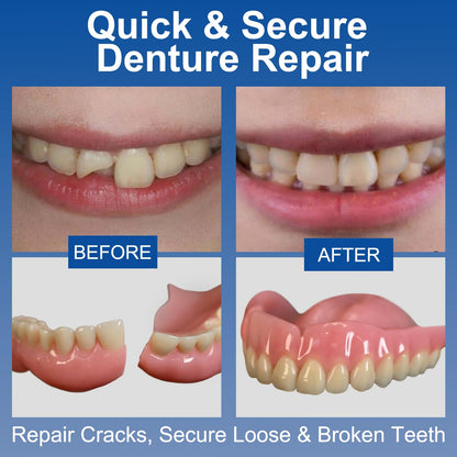Dental Lab Instant Bonding Dental Glue (1 oz) – Denture Repair, Secure Loose or Broken Teeth, Clear, Non-Irritating Odor