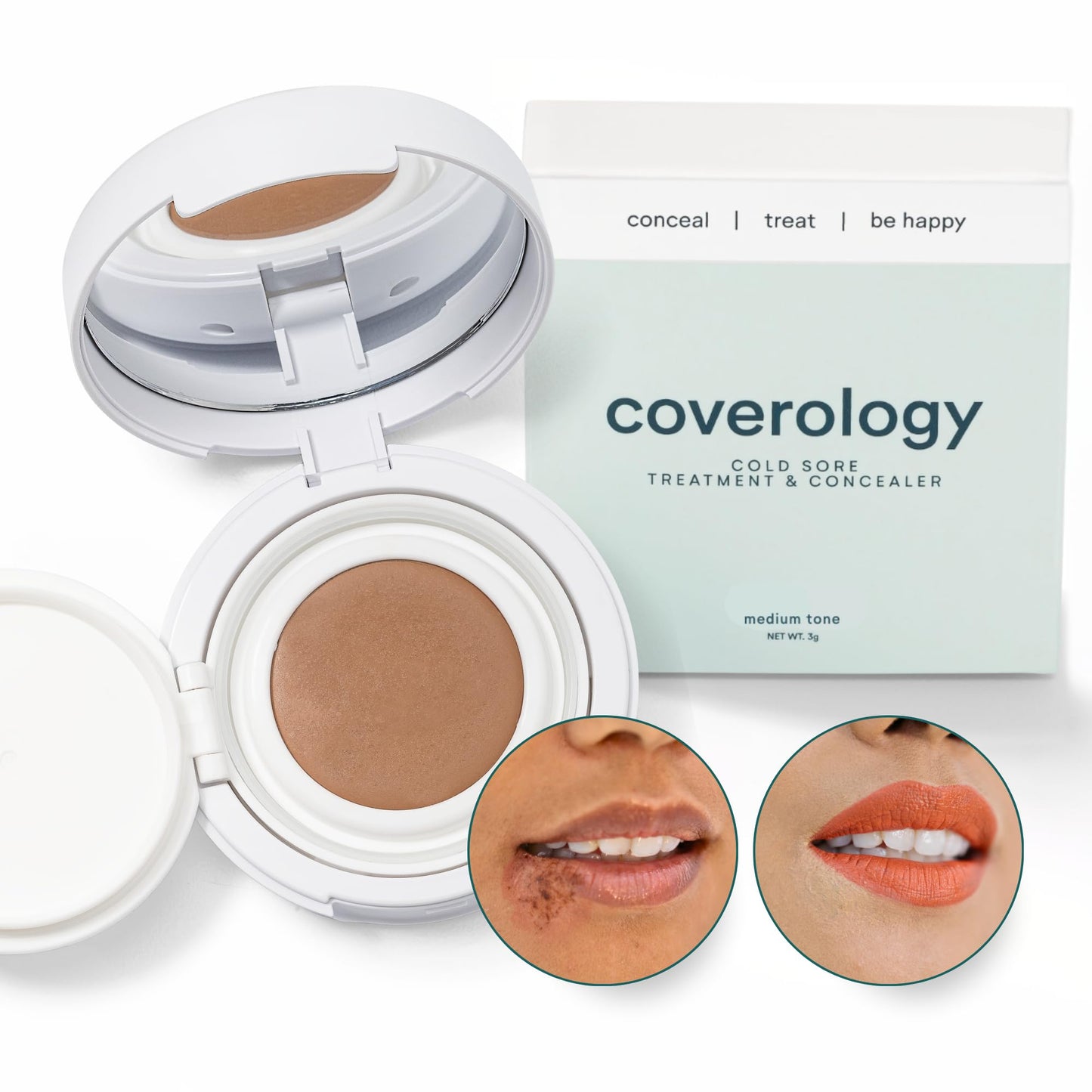 Coverology Cold Sore Treatment & Concealer – Full Coverage Cold Sore Cover-Up