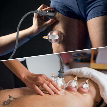Cupping Set – Professional Chinese Acupoint Therapy, 22-Cup Portable with Vacuum Pump & Travel Case