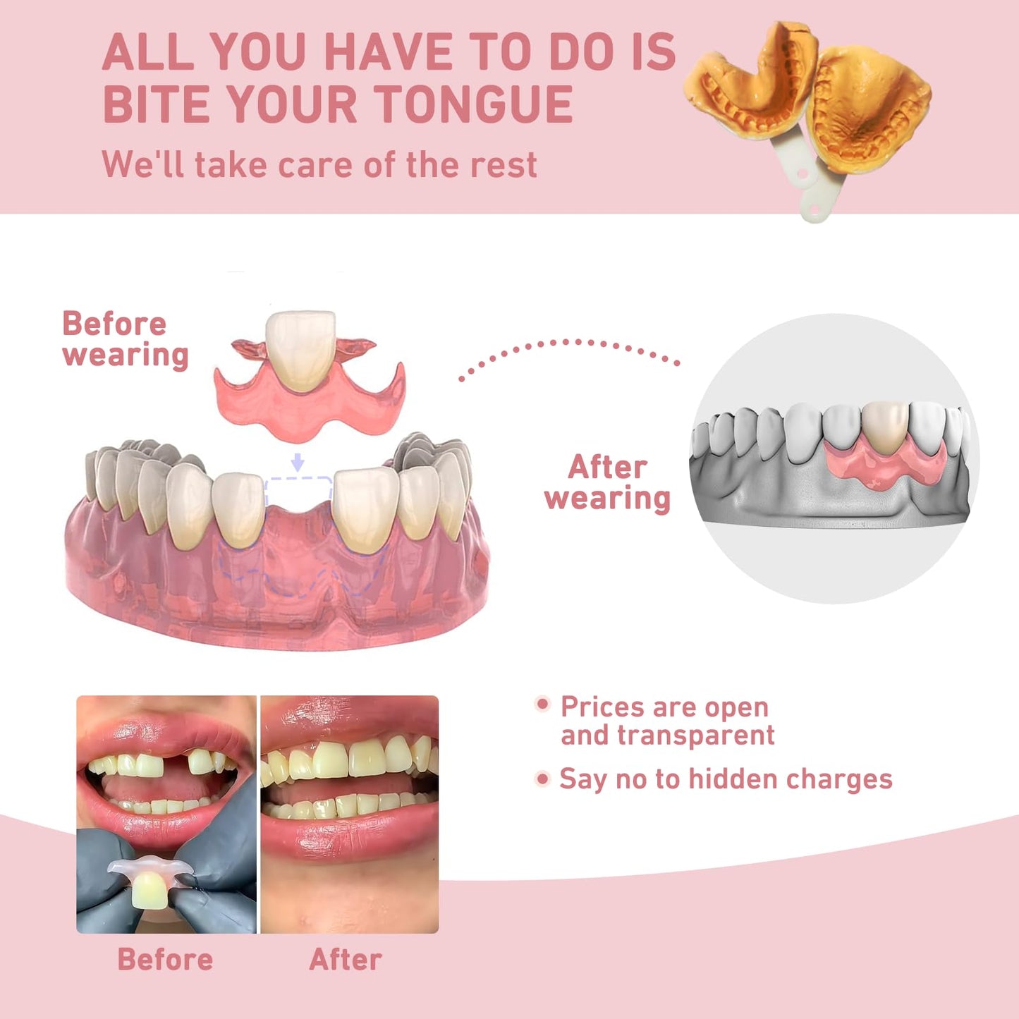 Custom Partial Dentures – Personalized Removable Denture Set (1–6 Teeth) with Storage Case