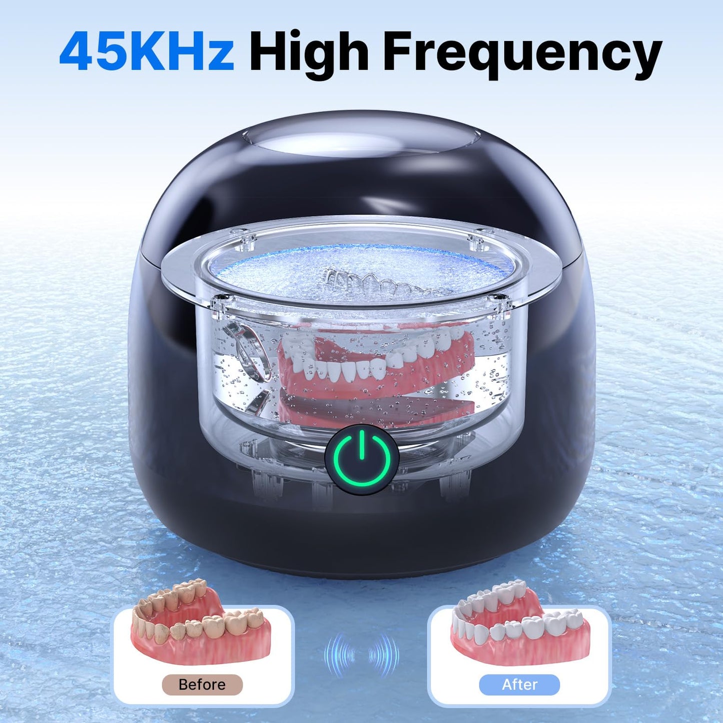 CXRUY Ultrasonic Retainer Cleaner – UV Dental Cleaning Pod for Dentures, Aligners, Braces, Jewelry (Black)