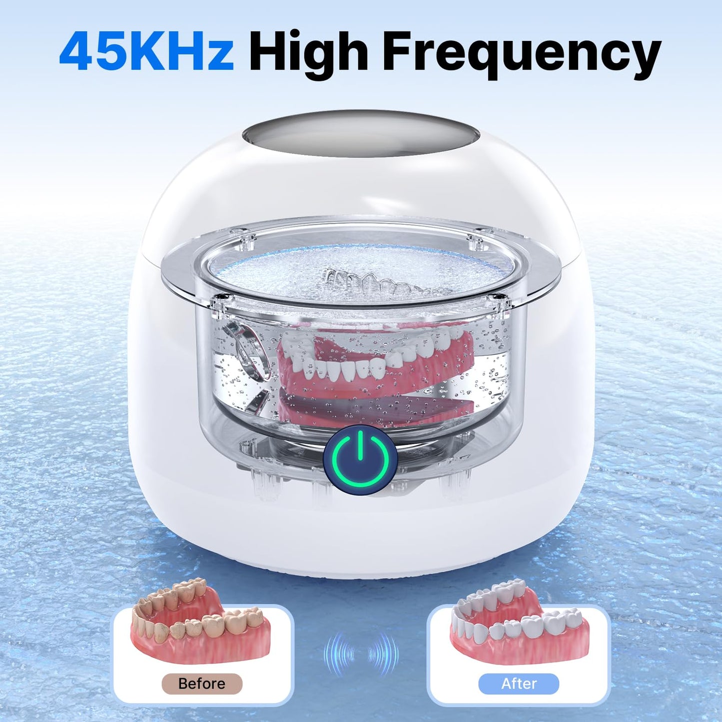 CXRUY Ultrasonic Retainer Cleaner – UV Dental Cleaning Pod for Dentures, Aligners, Braces & Jewelry (White)