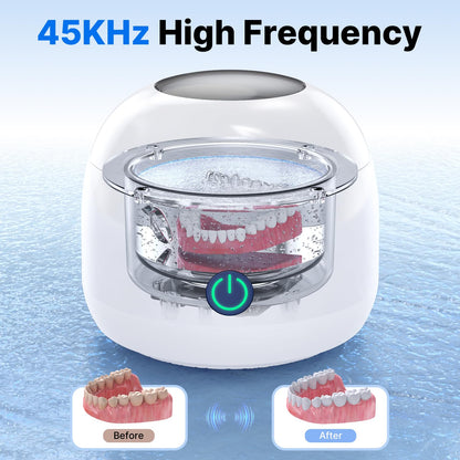 CXRUY Ultrasonic Retainer Cleaner – UV Dental Cleaning Pod for Dentures, Aligners, Braces & Jewelry (White)