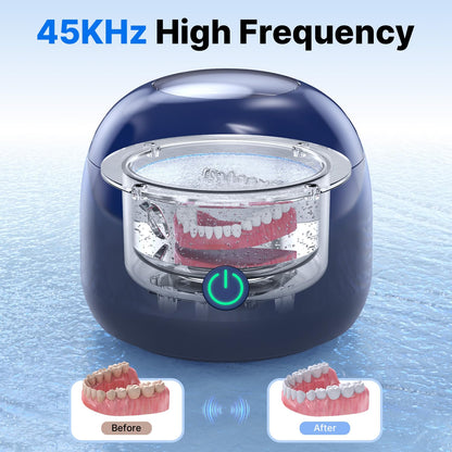CXRUY Ultrasonic Retainer Cleaner - UV Dental Cleaning Pod (Navy Blue)