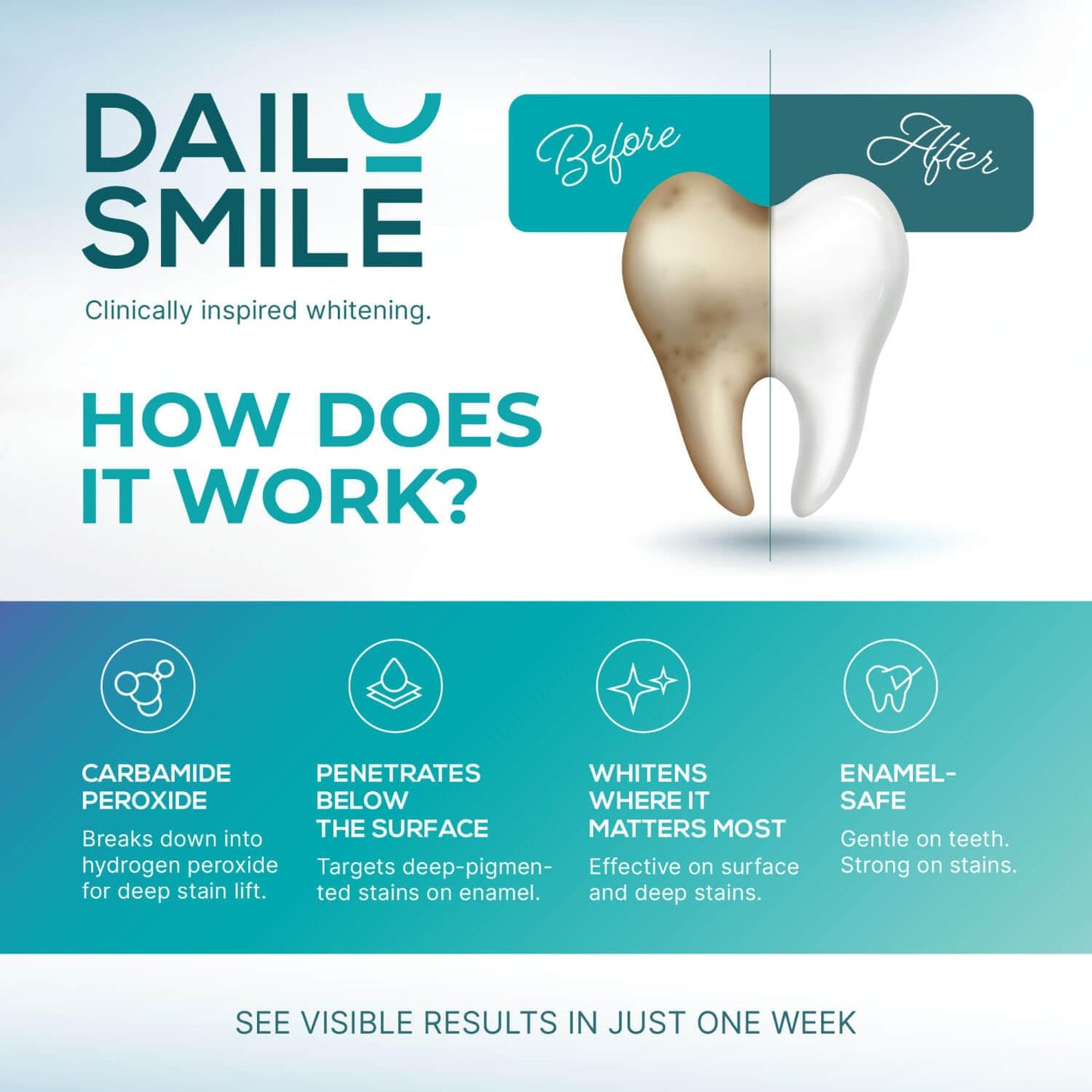 Dailysmile Teeth Whitening Kit with LED | Safe for Sensitive Teeth | Hands-Free, Waterproof LED Light