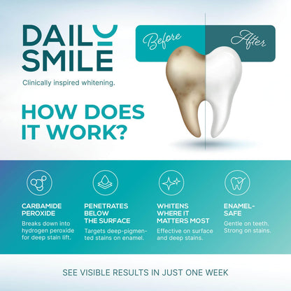 Dailysmile Teeth Whitening Kit with LED | Safe for Sensitive Teeth | Hands-Free, Waterproof LED Light