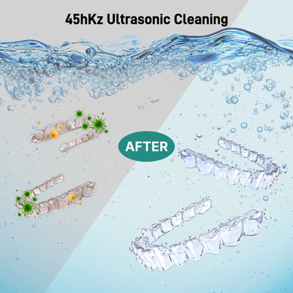 Ultrasonic Retainer Cleaner 45kHz + UV Light – 200ml Cleaning Pod (White) for Dentures, Aligners, Jewelry