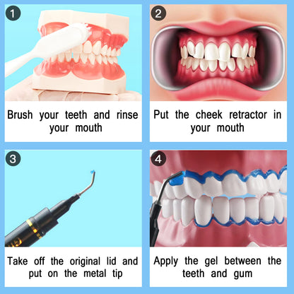 Dental Gingival Barrier Protection Gel – 10Pcs, 3ML Gum Protector for Teeth Whitening