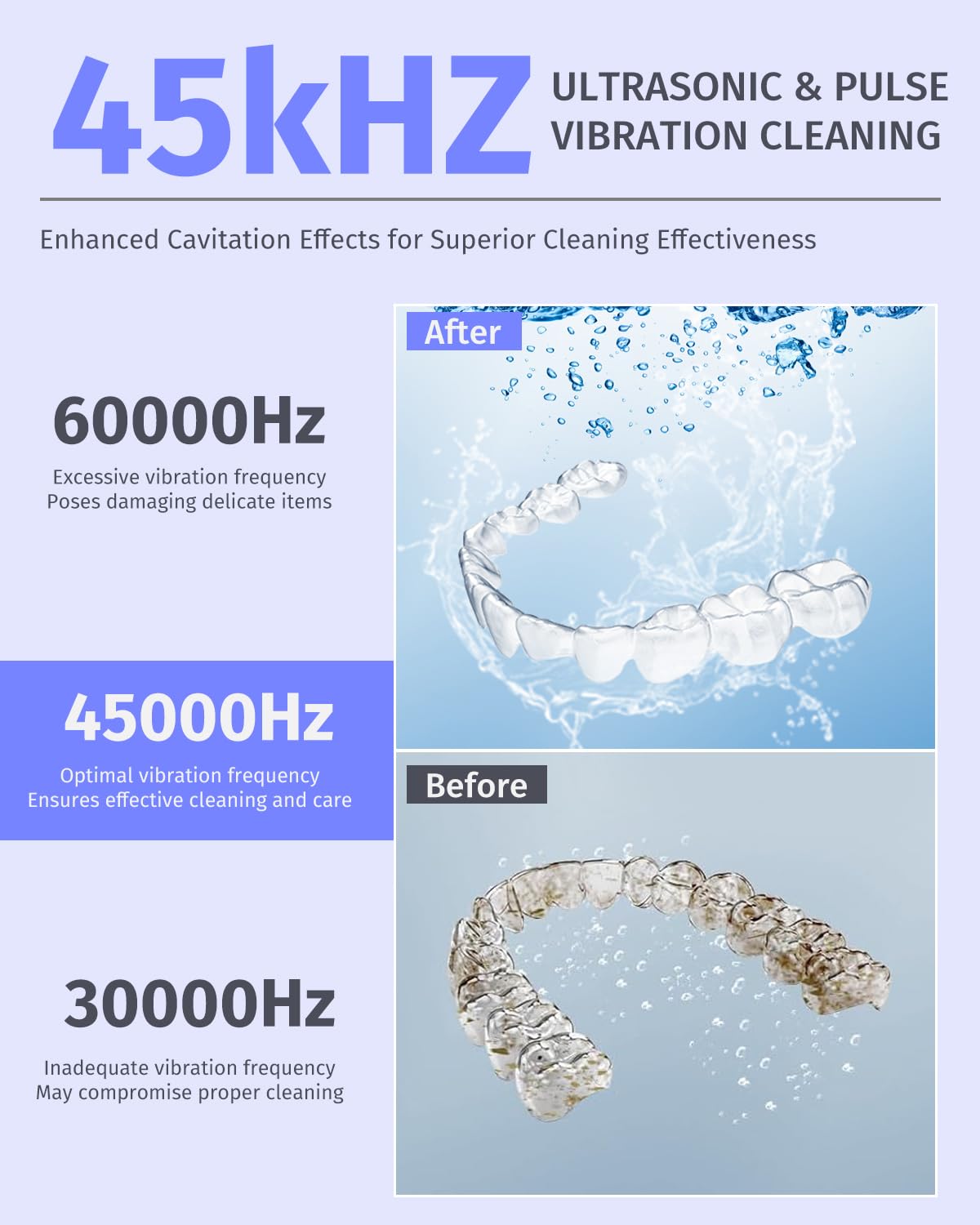 Dental Ultrasonic Retainer Cleaner – 45kHz, 4-Mode UV Denture Cleaner, 200ml Portable (White)