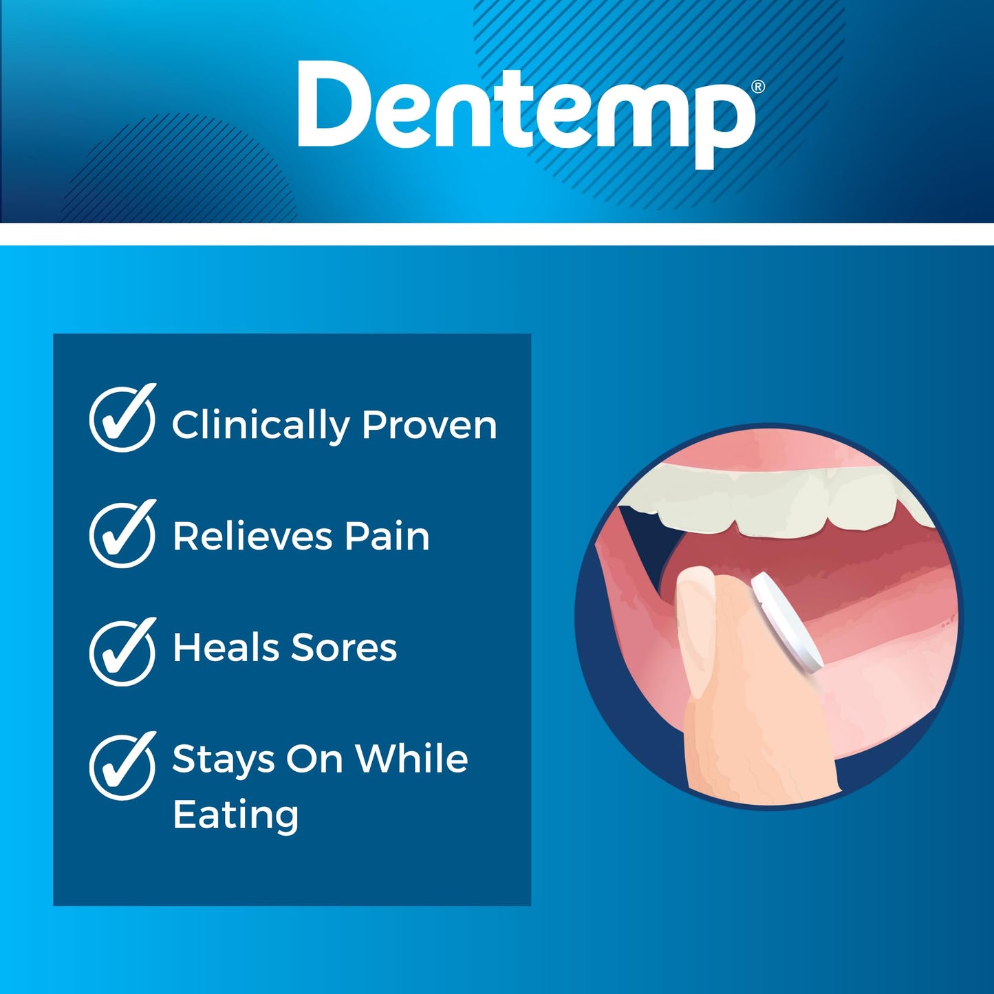 Dentemp Canker Cover 2pk – Canker Sore Medicine & Pain Relief (12 Count) for Adults