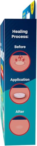Dentemp Canker Cover – Canker Sore Pain Relief Tablets (16 Count)