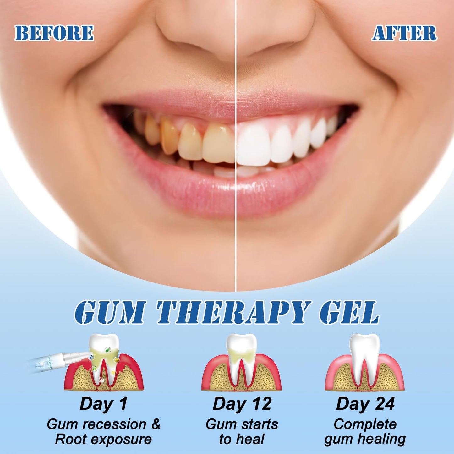 Neslemy Gum Shield Therapy Gel – Gum Therapy Gel, Teeth Whitening Essence Pen (Pack of 3)