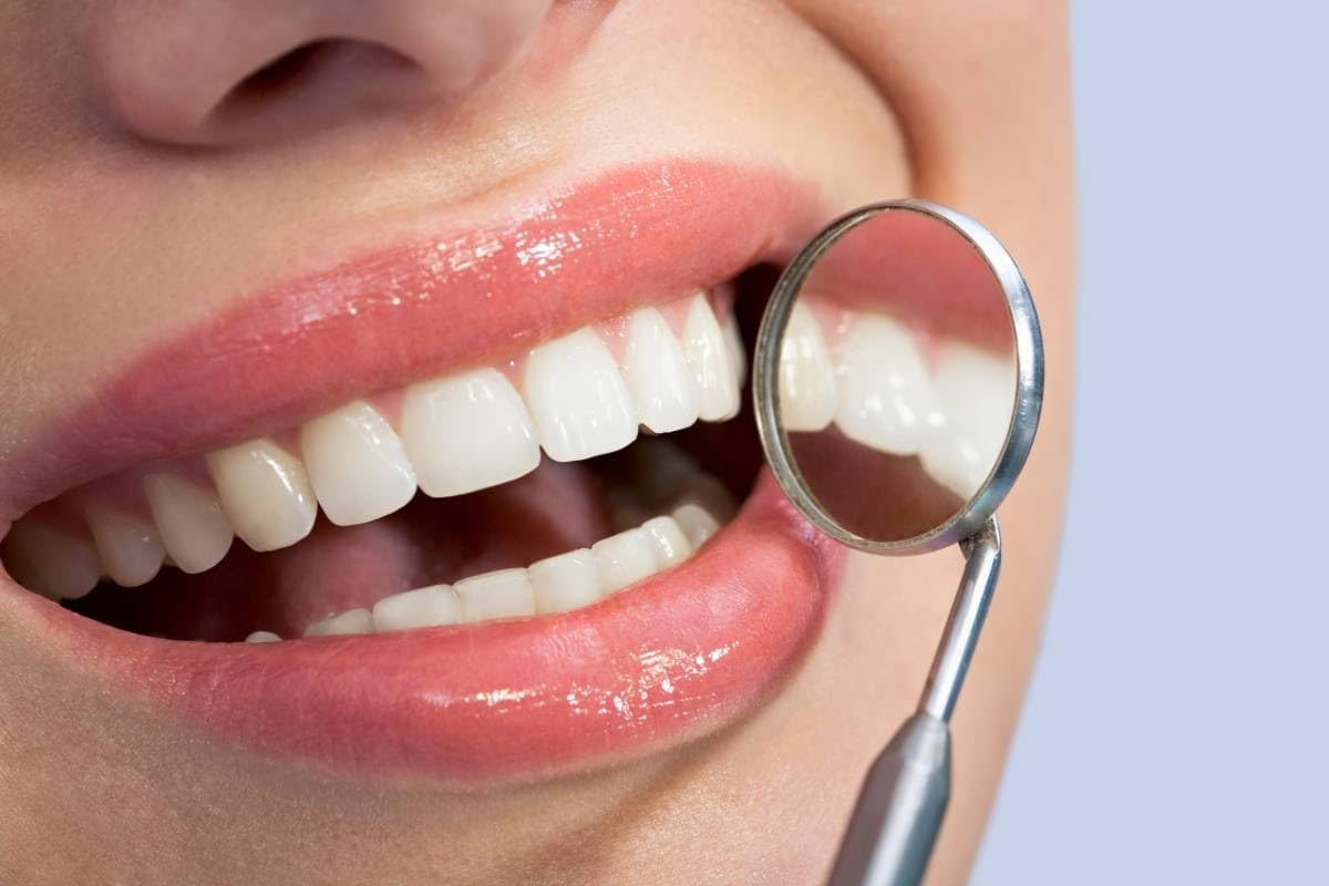 Denture Do It Yourself Full Set - Top & Bottom Dentures, Partial & Full Dentures DIY Kit | Create Your Perfect Smile at Home