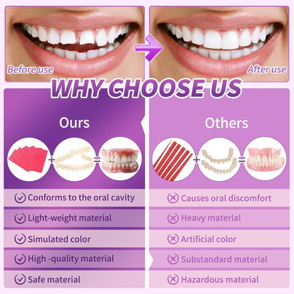 At-Home DIY Denture Kit: Full Upper & Lower Dentures for Smile Transformation – ZZ6