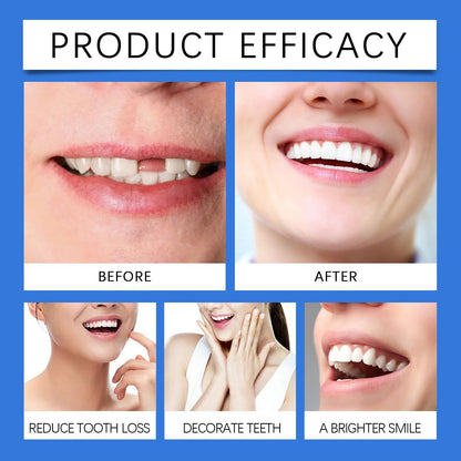 Xinshijie Soft Silicone Denture Liners - Comfortable Upper & Lower Set