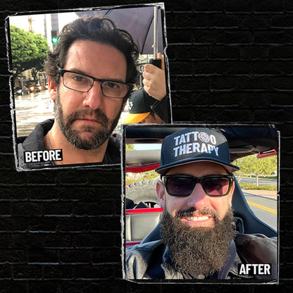 Derm Dude Beard Growth Gummies for Men — Biotin 10,000 mcg | 60 Gummies