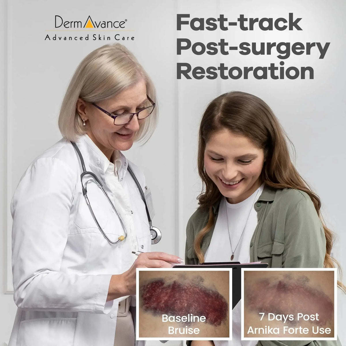 DermAvance Arnika Forte Capsules – Post-Surgery Swelling & Bruising Support (Arnica 1000mg, Bromelain 125mg, 14 capsules) BritishVita | Premium UK Vitamins & Wellness Supplements