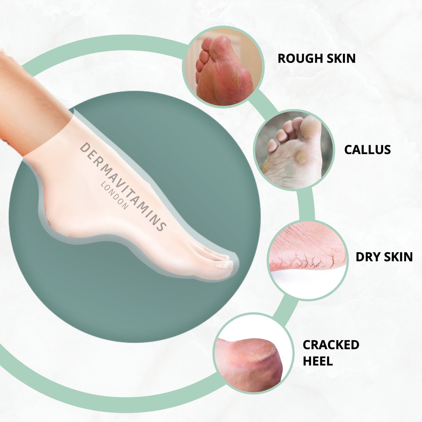 Dermavitamins Advanced Foot Mask Bag - Repairs Dry Feet Treatments (Peeling - Moisturising - Exfoliating)
