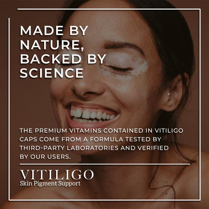Dermawonder Vitiligo Capsules 60 Count - Support Pigmentation & Reduce White Spots