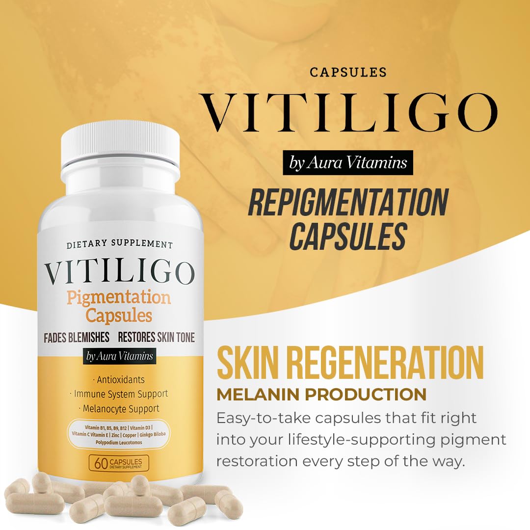Dermawonder Vitiligo Capsules (60 Count) – Improve Skin Pigmentation & Reduce White Spots