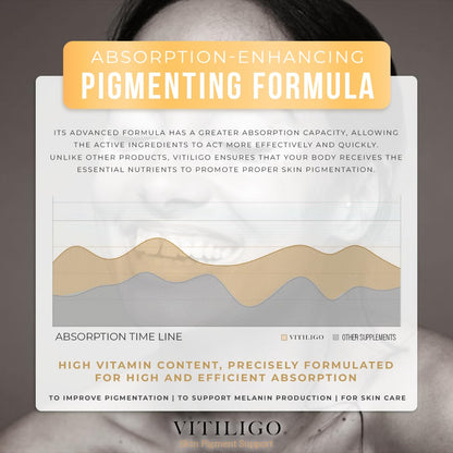 Dermawonder Vitiligo Capsules 60 Count - Support Pigmentation & Reduce White Spots