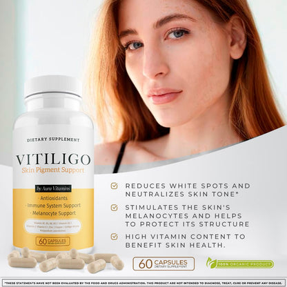 Dermawonder Vitiligo Capsules 60 Count - Support Pigmentation & Reduce White Spots