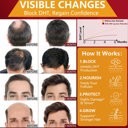 DHT Blocker for Men | Extra Strength Saw Palmetto & Biotin Hair Growth Supplement - Hair Growth Vitamins - Hair Regrowth - Natural Hair Loss Supplements for Men - Proprietary Herbal Blends,1 Pack