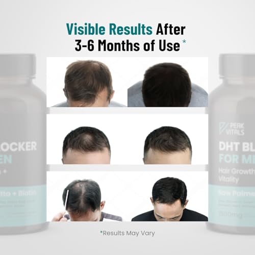 DHT Blocker for Men – Potent Hair Growth Formula | Saw Palmetto, Biotin, Pumpkin Seed | USA Made | 90 Capsules