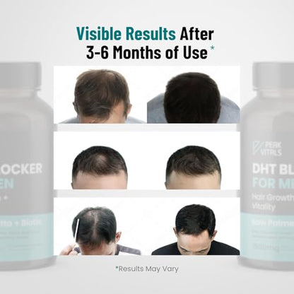 DHT Blocker for Men – Potent Hair Growth Formula | Saw Palmetto, Biotin, Pumpkin Seed | USA Made | 90 Capsules