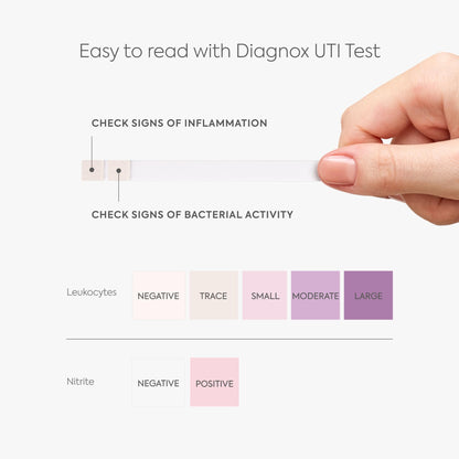 Diagnox Health UTI Test Strips for Women – 25 Count | 2-Minute Results