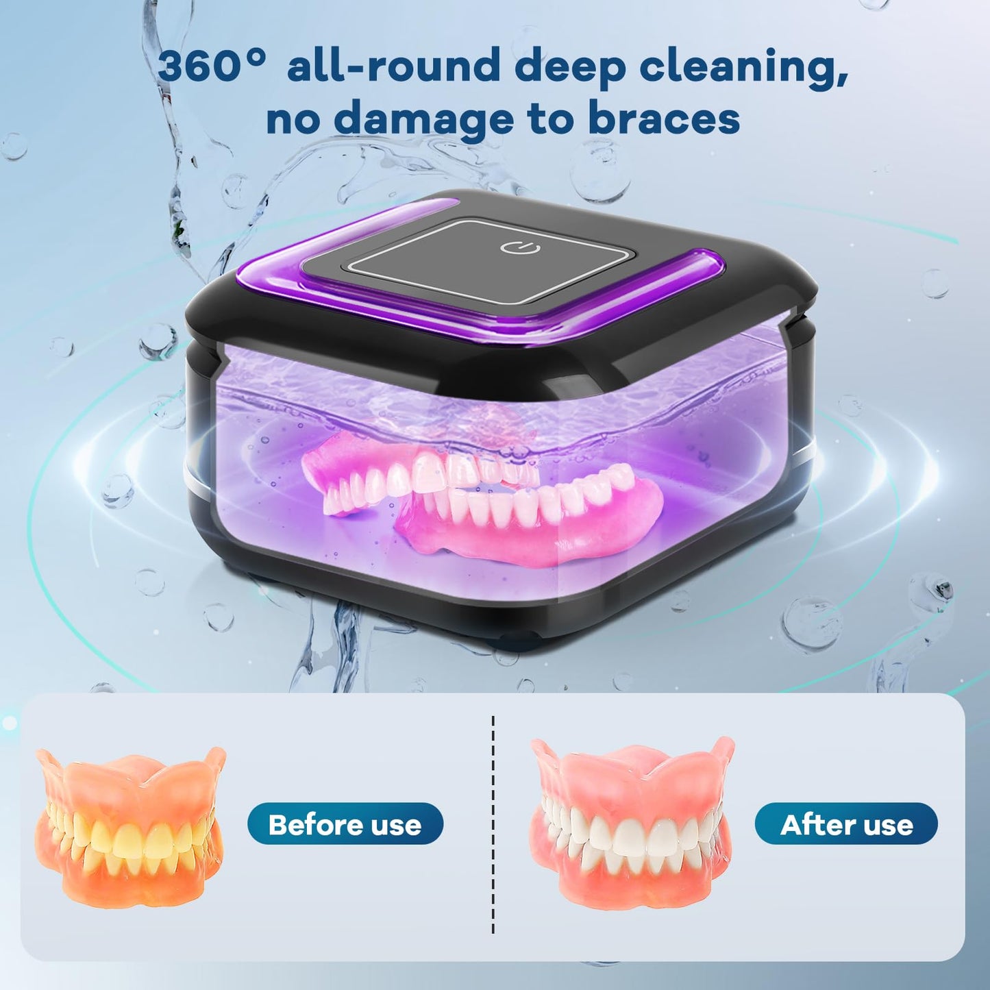 Ultrasonic Retainer Cleaner Machine | 42kHz, 28W Denture Cleaner for Night Guards, Braces, Jewelry – 180ml
