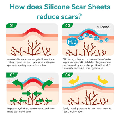 Dimora Medical Grade Silicone Scar Sheets - Ultra Soft Waterproof Scar Tape (1.6x120 Roll)