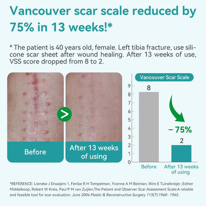 Dimora Medical Grade Silicone Scar Sheets - Ultra Soft Waterproof Scar Tape (1.6x120 Roll)