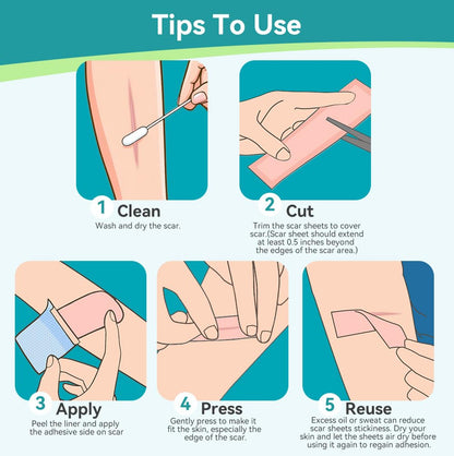 Dimora Medical Grade Silicone Scar Sheets — Ultra Soft Scar Tape (1.6x60 in), Hypoallergenic & Sensitive-Skin Safe