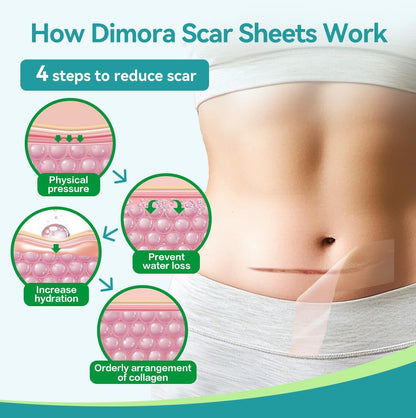 Dimora Medical Grade Silicone Scar Sheets — Ultra Soft Scar Tape (1.6x60 in), Hypoallergenic & Sensitive-Skin Safe