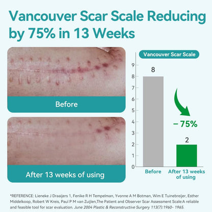 Dimora Medical Grade Silicone Scar Sheets — Ultra Soft Scar Tape (1.6x60 in), Hypoallergenic & Sensitive-Skin Safe