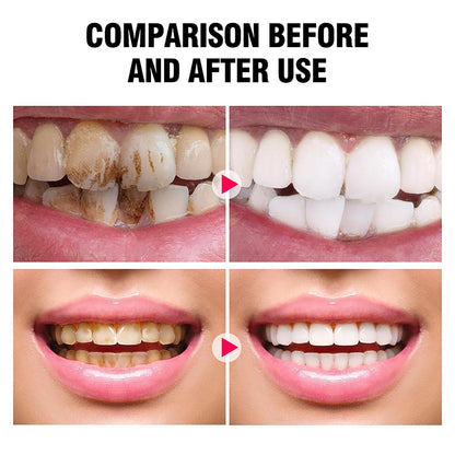 DISAAR BEAUTY Smokers Tooth Powder – Remove Tobacco Stains & Whitens Teeth (50g)