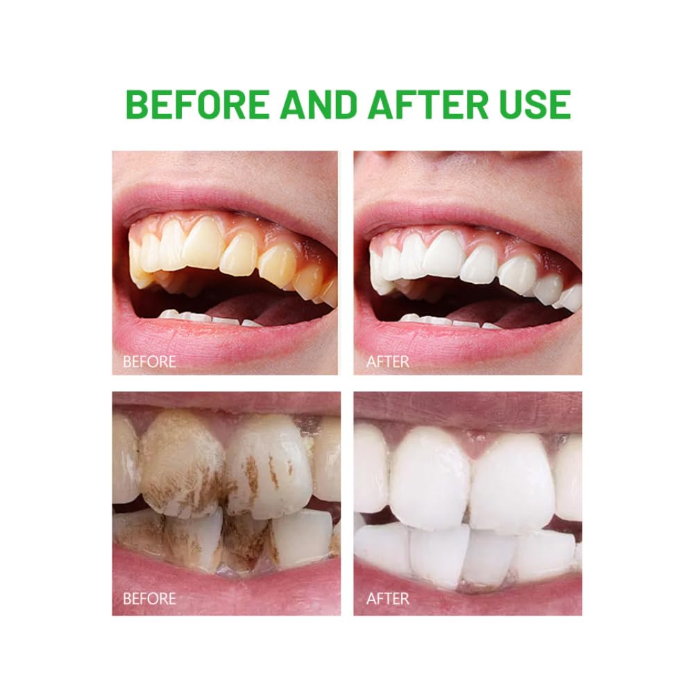 DISAAR Beauty Rosemary Toothpaste – Herbal Extract, Clove & Probiotics | Removes Stains & Stronger Teeth 100g