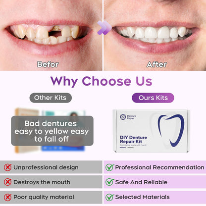 DIY Denture Kit - Full Top & Bottom Teeth - Functional