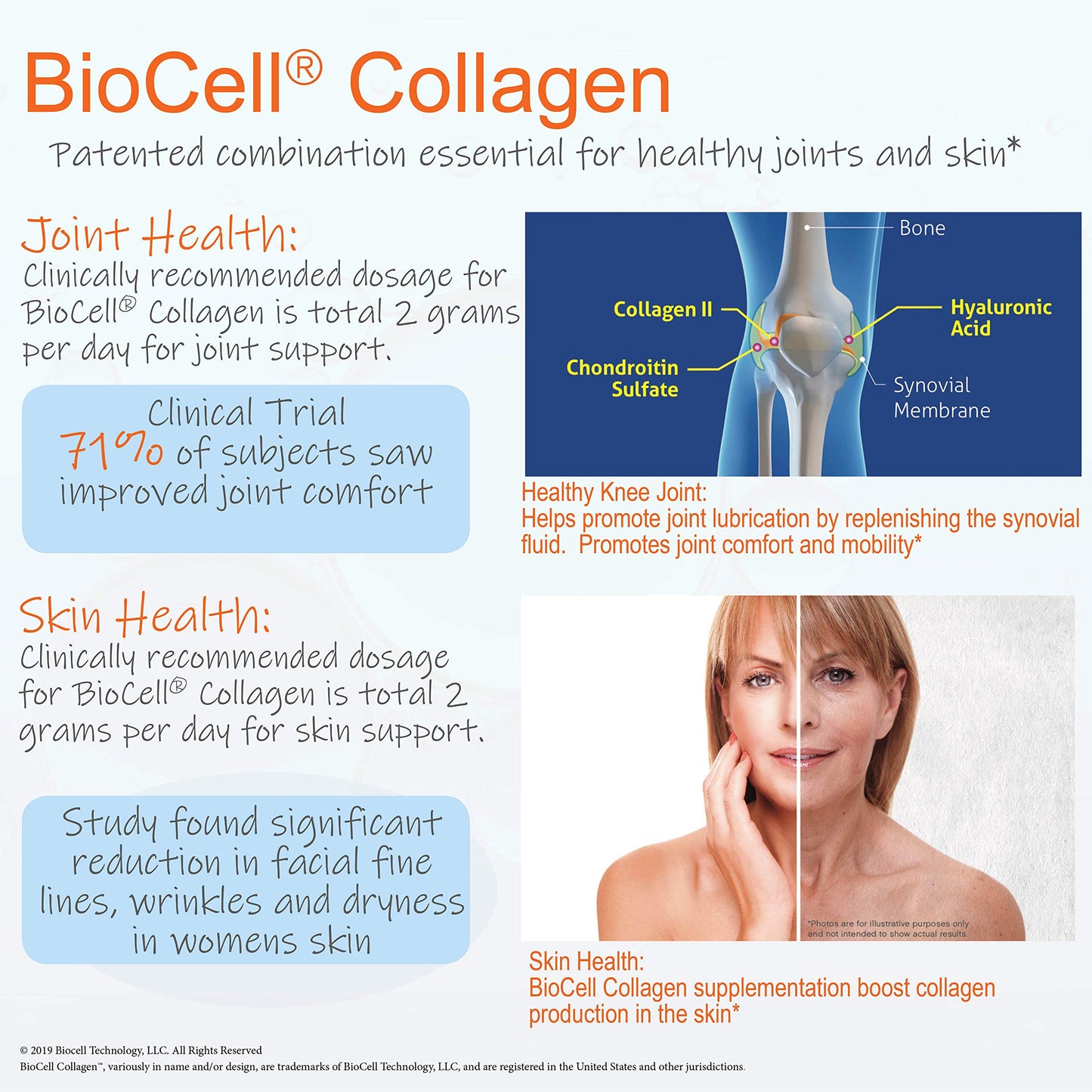 Doctor's Best Hyaluronic Acid with Chondroitin Sulfate Featuring BioCell Collagen – Joint Support, Skin Health, Non-GMO, Gluten Free, Soy Free, 180 Count