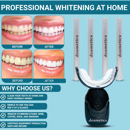 DOSMETICS Teeth Whitening Kit with LED Light – 4 Carbamide Peroxide Gel Pens & Wireless Mouthpiece