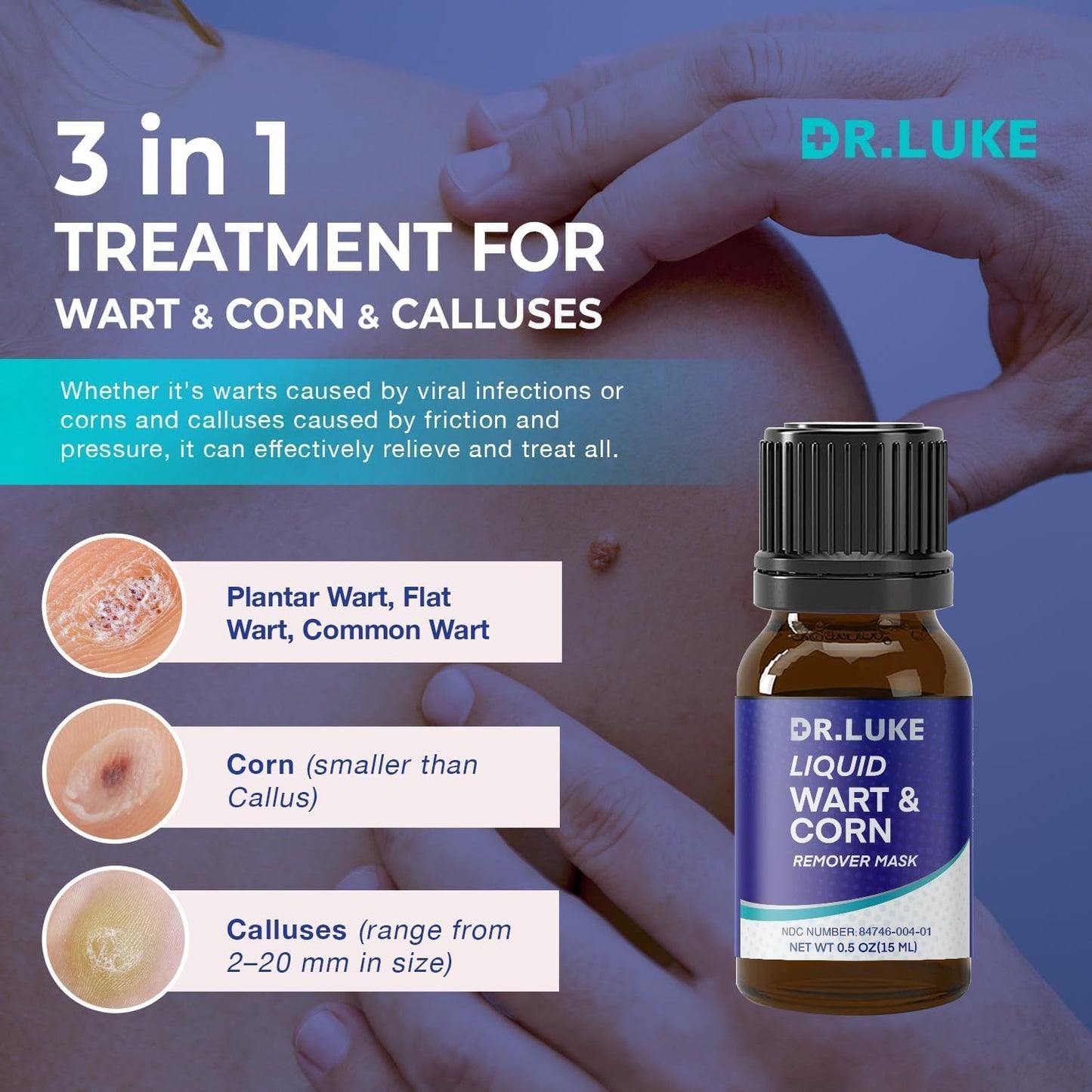 Dr. Luke Plantar Wart Corn Remover Freeze Off 17% Salicylic Acid — 2 Pack