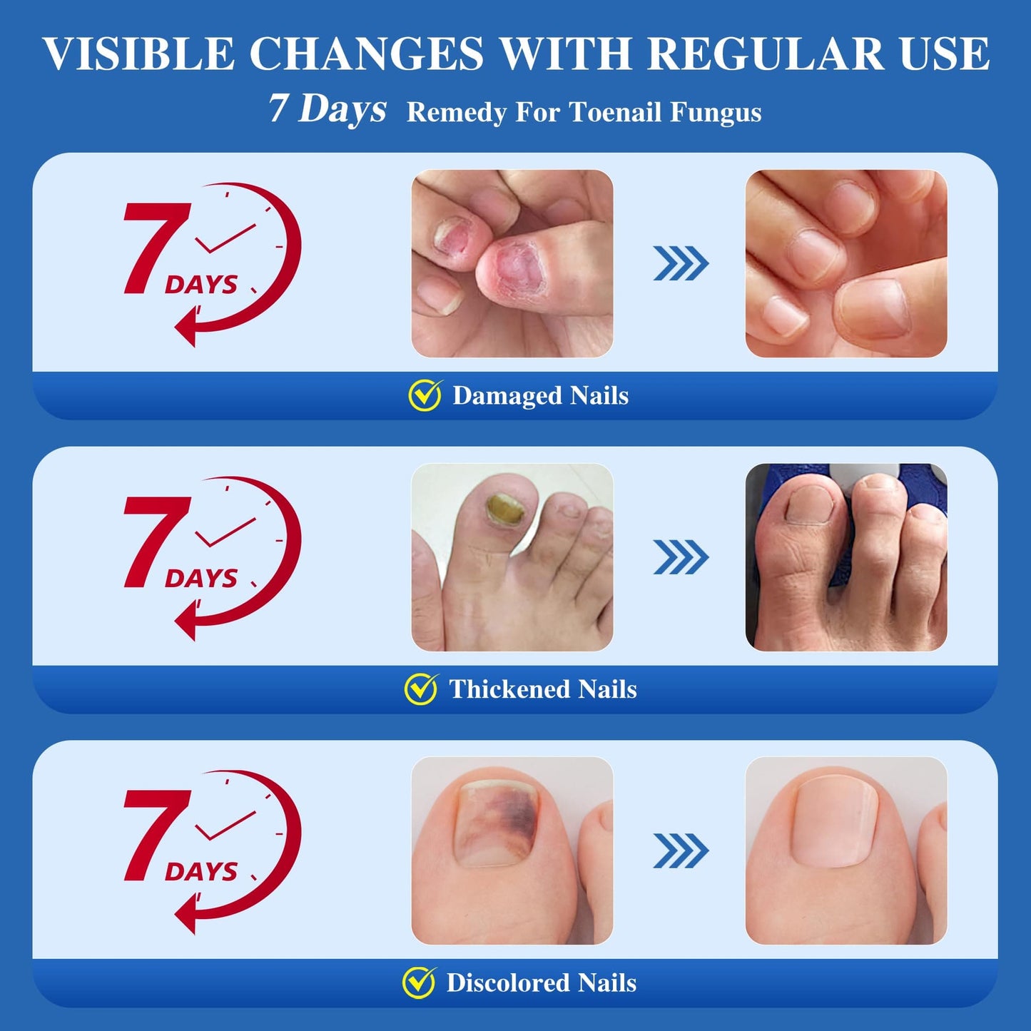 DR.RAPID Toenail Fungus Treatment Extra Strength - Fast-Acting Nail Repair with Tea Tree Oil