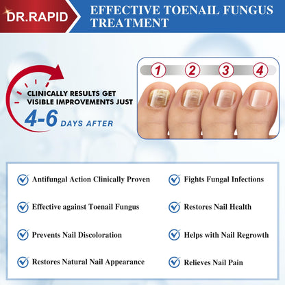 DR.RAPID Toenail Fungus Treatment Extra Strength - Fast-Acting Nail Repair with Tea Tree Oil
